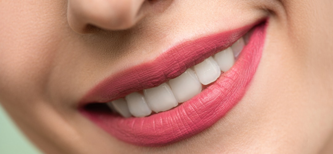 Cara Mengobati Gusi Bengkak